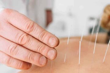 Traditional Chinese Medicine Acupuncture (TCM)